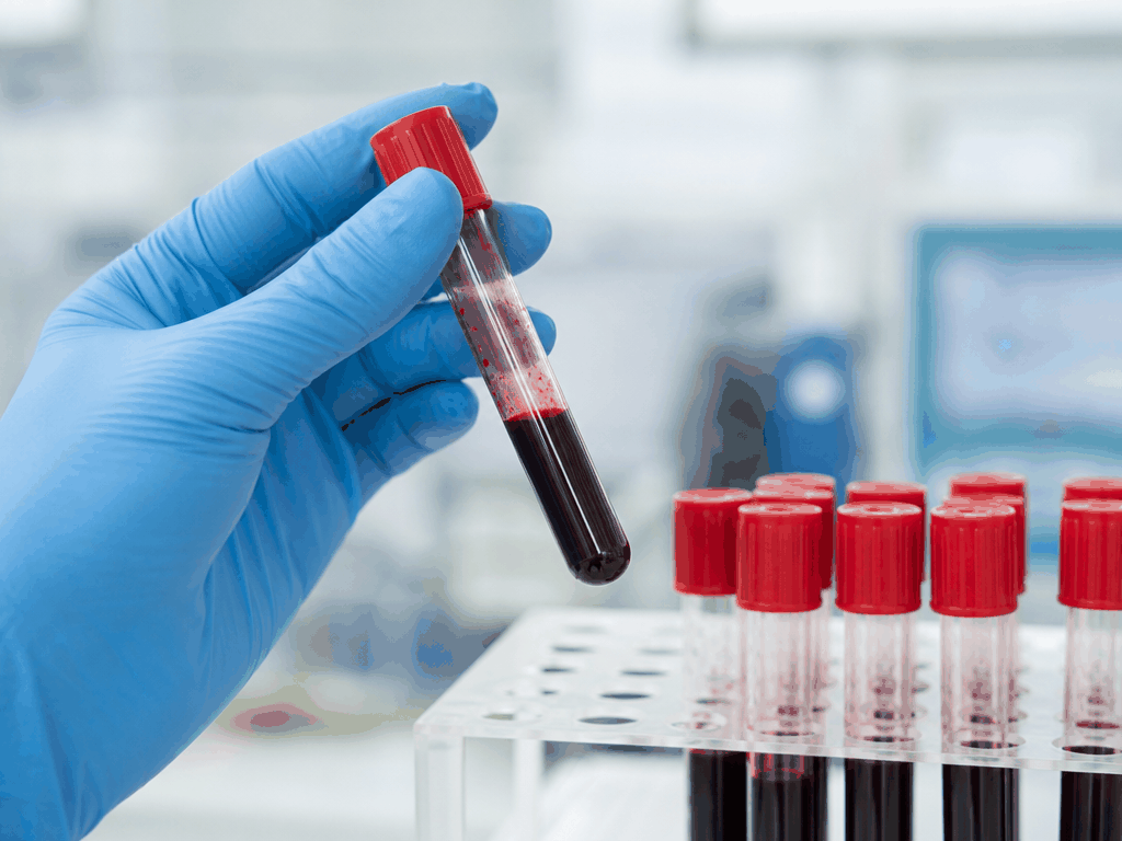 Exame de Sangue em Pets: Benefícios, Jejum e Como é Feito 1 Coleta de sangue em cães e gatos - procedimento veterinário na Oásis Pet